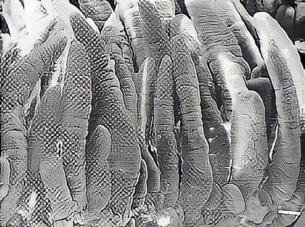 Villus heights of deodenum intestinal mucosa