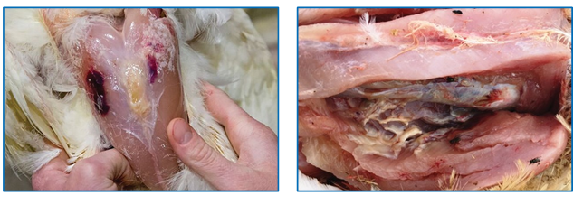 Figure 9: Lesions at the site of an IM injection.