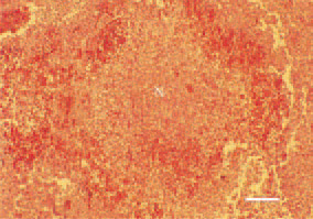Fig. 1. Widespread coagulative necrosis
(N) in the liver, surrounded
by a haemorrhagic zone as a manifestation
of staphylococcal septicaemia
in a hen. H/E, Bar = 35 µm.