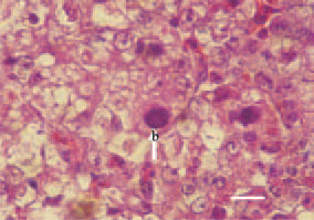 Fig. 2. The basophilic inclusion bodies
are usually big and fill tightly
the space around the nuclear membrane
(arrow – b). H/E, Bar = 10 µm.