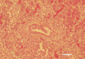 Fig. 6. Hyperplasia of pancreatic
ducts and mononuclear cell infiltration
in the portal zone. H/E, Bar = 50
µm.
