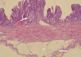 Fig. 2. Epithelial hyperplasia of glandular
crypts (arrow) and subserous
oedema (e). H/E, Bar = 35 µm.