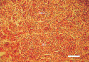 Fig. 1. The neoplastic changes begin
always from B. Fabricii, where intrafollicular
lymphomas (lim) of a various
size are observed. H/E, Bar = 50
µm.