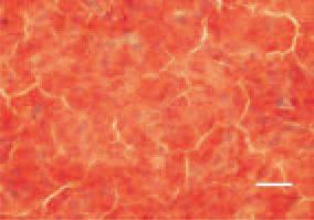 Fig. 2. Histologically, growth of singletype
lymphoblast cells with marked
pyroninophilia is observed. Tissue
cross-section, liver, methyl green pyronin
staining, H/E, Bar = 25 µm.