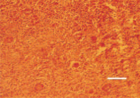 Fig. 19. Nephroblastoma. Young tubules
with a rosette-like structure.
H/E, Bar = 50 µm.