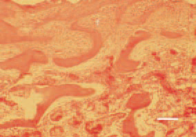 Fig. 5. Sagittal cross-section of the
proximal femur in a broiler chicken,
case of calcium deficiency. Replacement
of bone substance by a newly
grown fibrous (f) tissue. H/E, Bar =
30 µm.