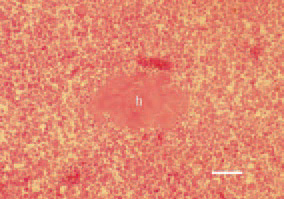 Fig. 2. Fatty liver haemorrhagic syndrome,
laying hen. Organization of a
haematoma (h) among the liver parenchyma.
H/E, Bar = 40 µm.