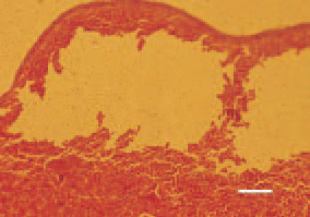 Fig. 3. Fatty liver haemorrhagic syndrome,
laying hen. Resorbed subcapsular
haematoma. H/E, Bar = 50 µm.