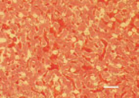 Fig. 3. Liver sinusoids are enlarged
and overfilled with blood. Supplementary
hepatic findings are the
oedema and atrophic degenerative
lesions. H/E, Bar = 50 µm.