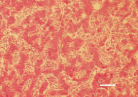Fig. 4. Compression atrophy of liver
parenchyma secondary to congested
sinusoids resulting from the passive
venous hyperaemia. H/E, Bar = 30
µm.