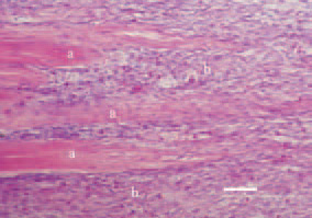 Fig. 4. The ends (a) of ruptured tendon,
embraced by the newly grown
connective tissue (b), H/E, Bar = 50
µm.