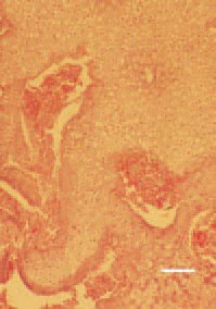 Fig. 2. Flow of abnormal masses of prehypertrophic cartilage,
sometimes occupying the entire metaphysis. There
is no adequate blood supply, only single blood vessels
penetrating from the metaphysis among the abnormal
cartilage. H/E, Bar = 35 µm. 