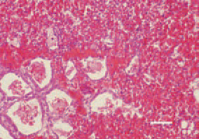 Fig. 2. RRA in a 14-day-old broiler
chicken. Oedema and haemorrhages
in the lungs. H/E, Bar = 35 µm.