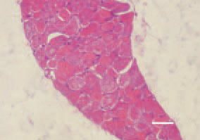 Fig. 1. & Fig. 2. Transverse/londitudinal
cross-section, thigh muscle, chicken,
after intoxication with high doses
maduramycin. Enhanced eosinophilia
and denenerative necrobiotic lesions
of muscle fibres. H/E, Bar = 40 µm.
