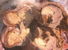 . Salpingitis.
In older cases, the caseous masses in the oviduct have a lamellar structure. E. coli organisms are usually found in excreta because of their presence in avian and mammalian intestine, the birds are constantly at risk of infection through contaminated water, dust, faeces and environment
