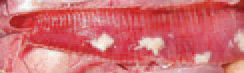 E. coli septicaemia of a respiratory origin.