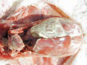 Acute septicaemic P. aeruginosa infection.
Serofibrinous inflammation of serous membranes in the pleuroperitoneal cavity (aerosacculitis, pericarditis, and perihepatitis) is detected. The lesions strongly resemble (imitate) these observed in E. coli septicaemia
