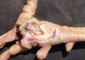 Plantar abscesses are a kind of local purulent inflammation. They are located on the plantar surface or adjacently to it and appear following puncture wounds. Staphylococci are moderately resistant to common disinfectants. Chlorine-containing disinfectants are efficient in the absence of organic matter.