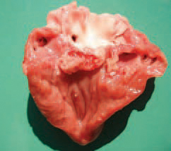 . Streptococcosis in poultry is encountered as acute septicaemia or chronic infections with a death rate between 0.5 and 50%. The agent that is most commonly associated with several pathological conditions in poultry is 5. zooepidemicus. The lesions in chronic streptococcal infections include arthrites, tenosynovites, myocardites and valve endocardites. Endocardites affect predominantly mitral valves and less frequently, aortal and tricuspid valves.
