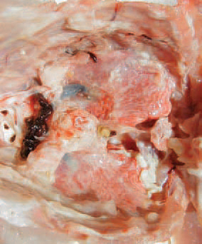 Serofibrinous pneumonias, usually bilateral, are a frequent finding.