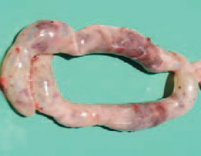 Ulcerative enteritis (UE) is characterized by inflammatory ulcerative and necrotic changes in intestinal mucosa and dystrophic necrobiotic lesions of the liver and the spleen. The clinical signs include a general malaise, ruffled feathers, diarrhoea and anaemia. In many instances, the disease begins with a sudden death. Pathoanatomically, deep button-like ulcers are observed, mainly in caeca and less frequently, in some parts of the small intestine, usually visible through the wall.