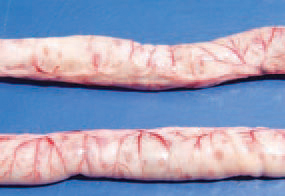 Ulcerative enteritis (UE) is characterized by inflammatory ulcerative and necrotic changes in intestinal mucosa and dystrophic necrobiotic lesions of the liver and the spleen. The clinical signs include a general malaise, ruffled feathers, diarrhoea and anaemia. In many instances, the disease begins with a sudden death. Pathoanatomically, deep button-like ulcers are observed, mainly in caeca and less frequently, in some parts of the small intestine, usually visible through the wall.
