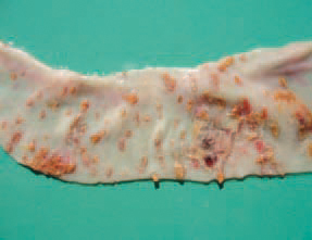 In older and larger ulcers, the haemorrhagic zones tend to disappear. The ulcers could have an irregular round or elongated shape and are covered by large necrotic diphtheritic membranes.