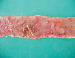 UE is a problem in all world regions with extensive poultry breeding. Young birds are infected more frequently although the disease is also common among adult quails. The early lesions appear like yellowish foci with haemorrhagic boundaries that could be seen from both the serous and the mucosal surfaces.