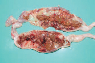 The aetiological agent is Clostridium colinum, a spore-forming organism, highly resistant to chemical agents and physical alterations. The intestinal content is often mixed with blood.