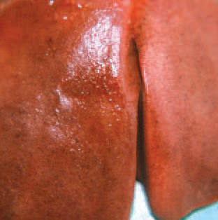 In most cases, no changes in viscera are observed. Rarely, gas bubbles could be found out in the liver. The diagnosis is confirmed by imprint preparations or histological cross sections. The bacterial agent could be isolated from cellulitic zones.