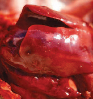 Single or multiple necroses are rarely seen in the liver. Prevention - the factors leading to skin injuries (cannibalism, mechanical traumas etc.) should be minimized. Successful approaches are the immunoprophylaxis programmes in breeder flocks aiming at prevention and reduction of possible immuno-suppressive states.