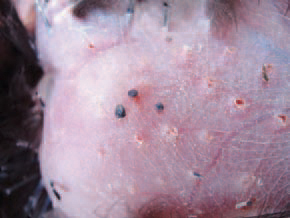 After removal of plumage, the ticks, adhered to the skin, are discovered. The aetiological agent is Borrelia anserina, a highly motile spirochaete with 5-8 coils. The organism is not resistant outside the host and could exist only in some vector.
