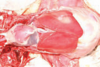 many instances of IBH, the amount of pericardial fluid is increased  (hydropericardium).