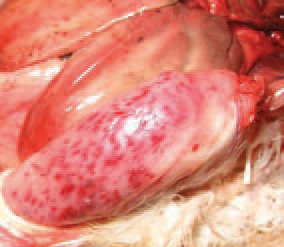 Clinical signs could be observed only several hours prior to death occurrence. They consist in pale comb and wattles, depression and apathy. Sometimes, the skin is icteric. Often, ecchymoses and striated haemorrhages in skeletal muscles are observed.