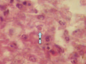 Microscopically, extensive dystrophic changes and necroses of liver parenchyma are detected. In the nuclei of hepatocytes, basophilic or eosinophilic inclusion bodies are detected. The basophilic inclusion bodies are usually dense and occupy the entire nuclear inner space (arrow b), whereas the eosinophilic ones are round or irregularly shaped and surrounded by a light halo (arrow e). The diagnosis is based upon the typical gross lesions and the history records.