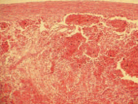 , hyperplasia of the white spleen pulp, necroses, subcapsular and periarteriolar haemorrhages are observed.