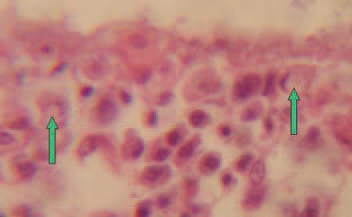 Similar inclusion bodies could be sometimes found out in lamina propria of the intestinal mucosa.