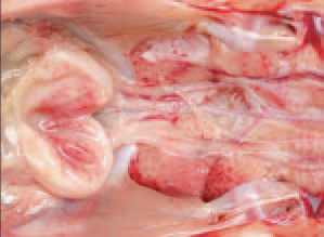 IBD virus has a lymphocidic effect and the most severe injuries are in the lymph follicles of the bursa of Fabricius. Most commonly, IBD begins as a serous bursitis.