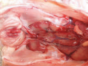 IBD lesions undergo various stages of serous haemorrhagic to severe haemorrhagic inflammation. The morbidity rate is very high and could reach 100%, whereas the mortality rate: 20 - 30%. The course of the disease is 5-7 days and the peak mortality occurs in the middle of this period.