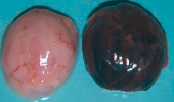 IBD lesions undergo various stages of serous haemorrhagic to severe haemorrhagic inflammation. The morbidity rate is very high and could reach 100%, whereas the mortality rate: 20 - 30%. The course of the disease is 5-7 days and the peak mortality occurs in the middle of this period.
