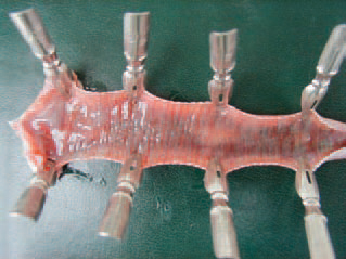 mucous coats of the larynx and the trachea are catarrhally haemorrhagically to fibrinously inflamed. Most outbreaks are encountered between the age of 4 and 14 weeks although the disease affects fowl of any age. LT is caused by a herpesvirus that is relatively resistant.