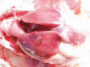 Inside the liver