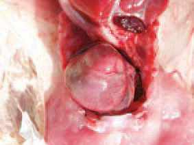 The aetiology is not known, but genetic factors or early viral myocarditis is supposed. The state is lethal in turkeys at the age of 1 - 4 weeks. Pathoanatomically, a severe dilated cardiomyopathy, often accompanied with ascitis, hydropericardium and congestion of other organs is detected.