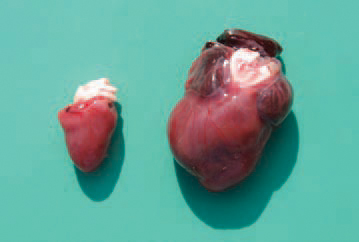 The aetiology is not known, but genetic factors or early viral myocarditis is supposed. The state is lethal in turkeys at the age of 1 - 4 weeks. Pathoanatomically, a severe dilated cardiomyopathy, often accompanied with ascitis, hydropericardium and congestion of other organs is detected.